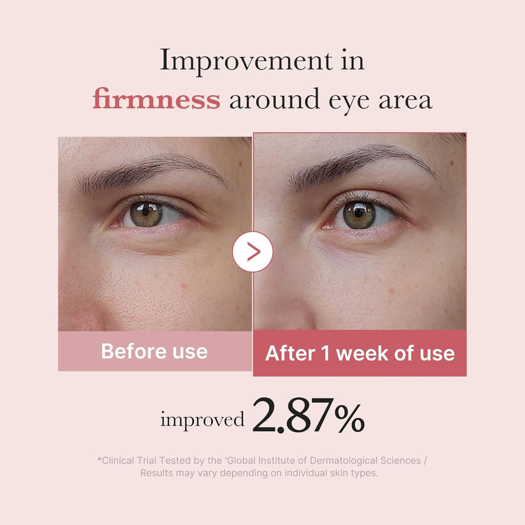 medicube Eye Cream with Salmon DNA PDRN & Pink Peptides | 99% Purity Retinol for Fine Lines | PDRN & Niacinamide Eye Serum for Uneven Skin Tone