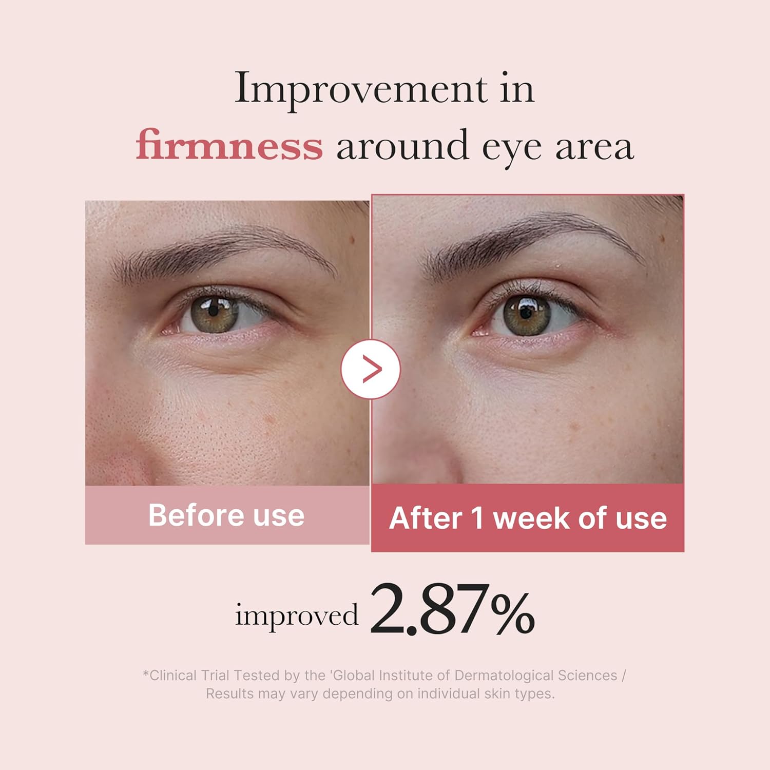 medicube Eye Cream with Salmon DNA PDRN & Pink Peptides | 99% Purity Retinol for Fine Lines | PDRN & Niacinamide Eye Serum for Uneven Skin Tone