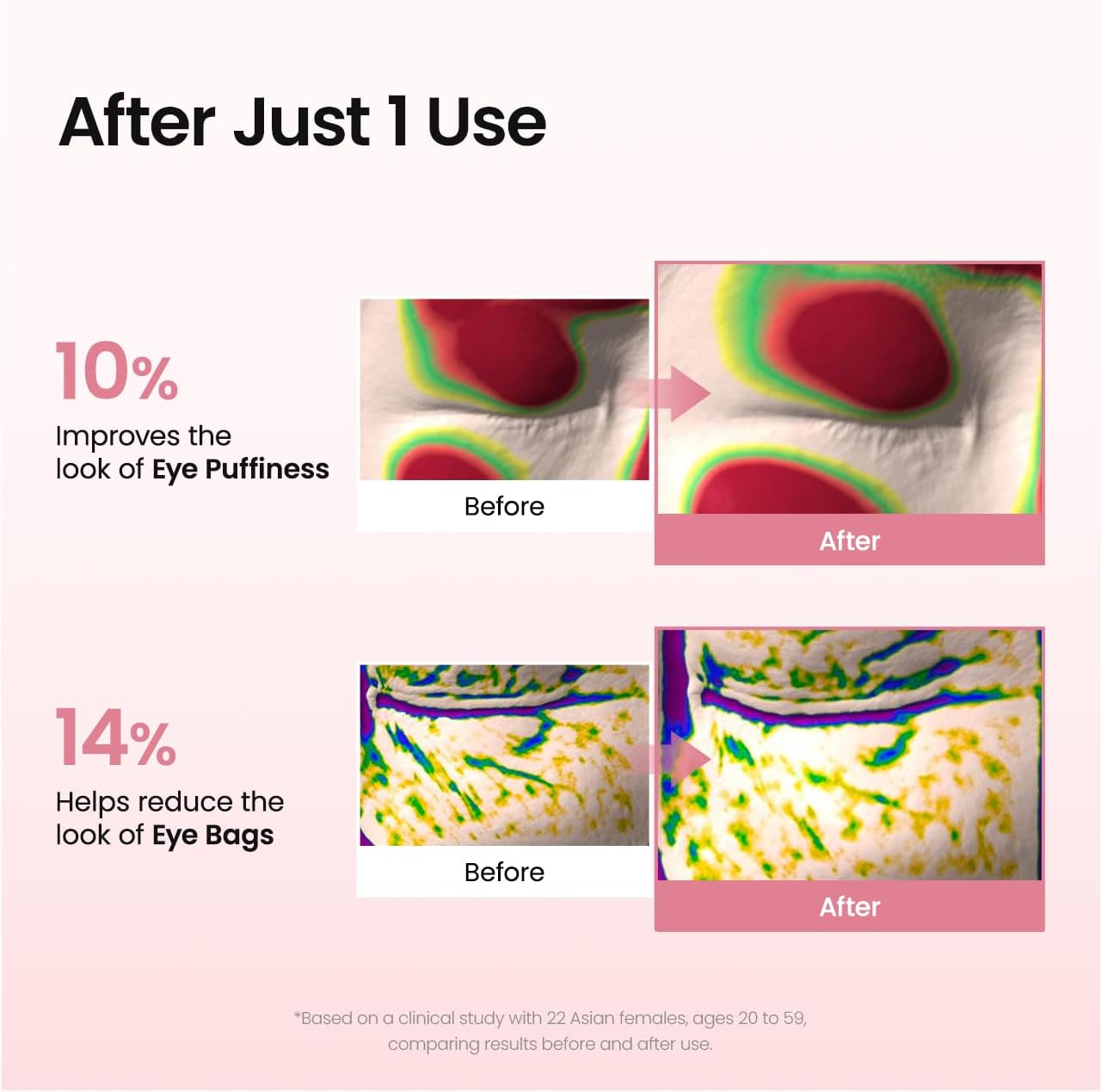 BIODANCE Collagen Peptide Under Eye Patches 60 Counts. Advanced Hydrogel Eye Patches for Dark Circles & Puffy Eyes. Under Eye Mask for Fine Lines. Eye Bags & Wrinkles. Korean Skincare