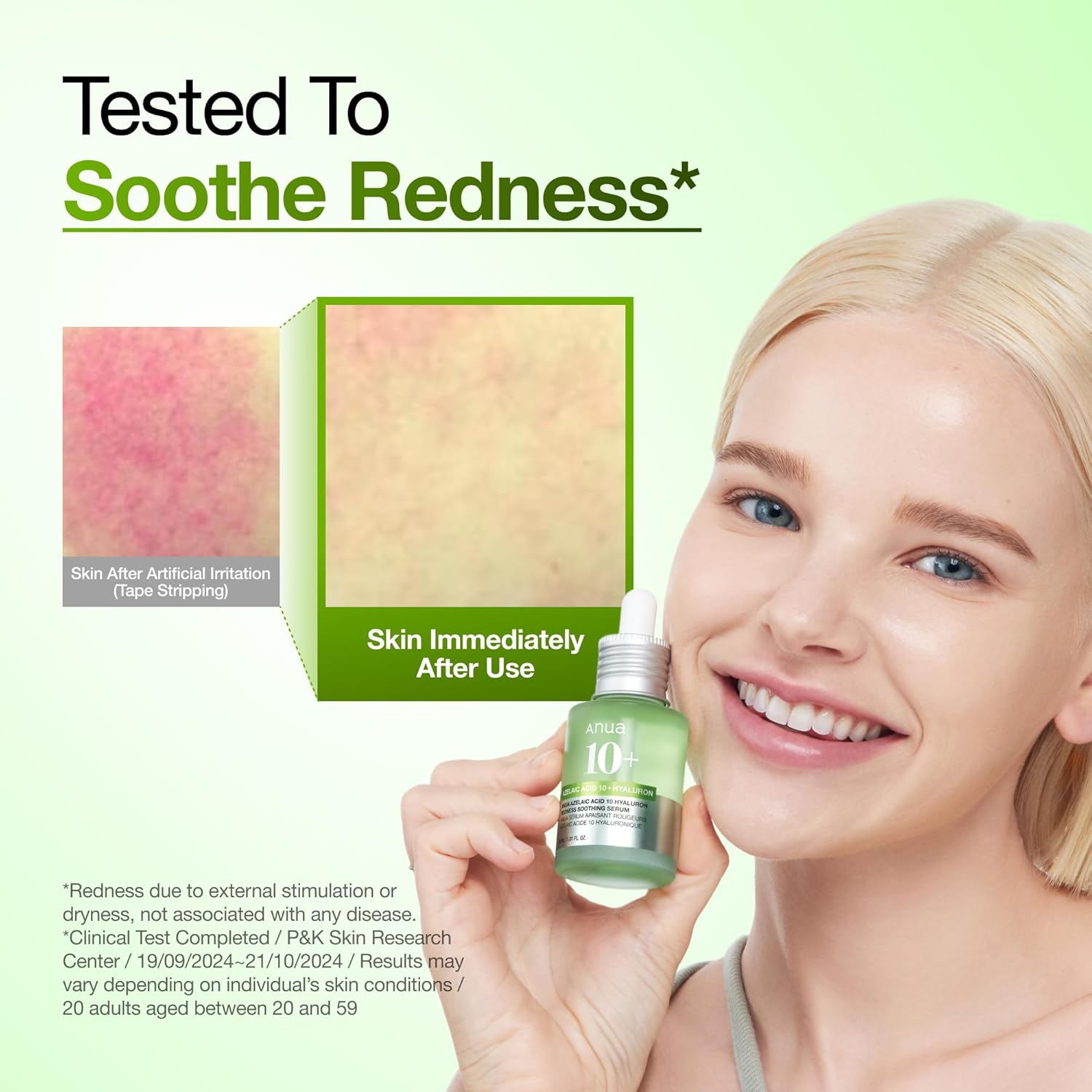 Anua Azelaic Acid 10 Hyaluron Redness Soothing Serum, Facial Serum for Blemish-Prone & Oily-Prone Skin, Lightweight & Hydrating Blemish Care, Hyaluronic Acid, Korean Skincare,